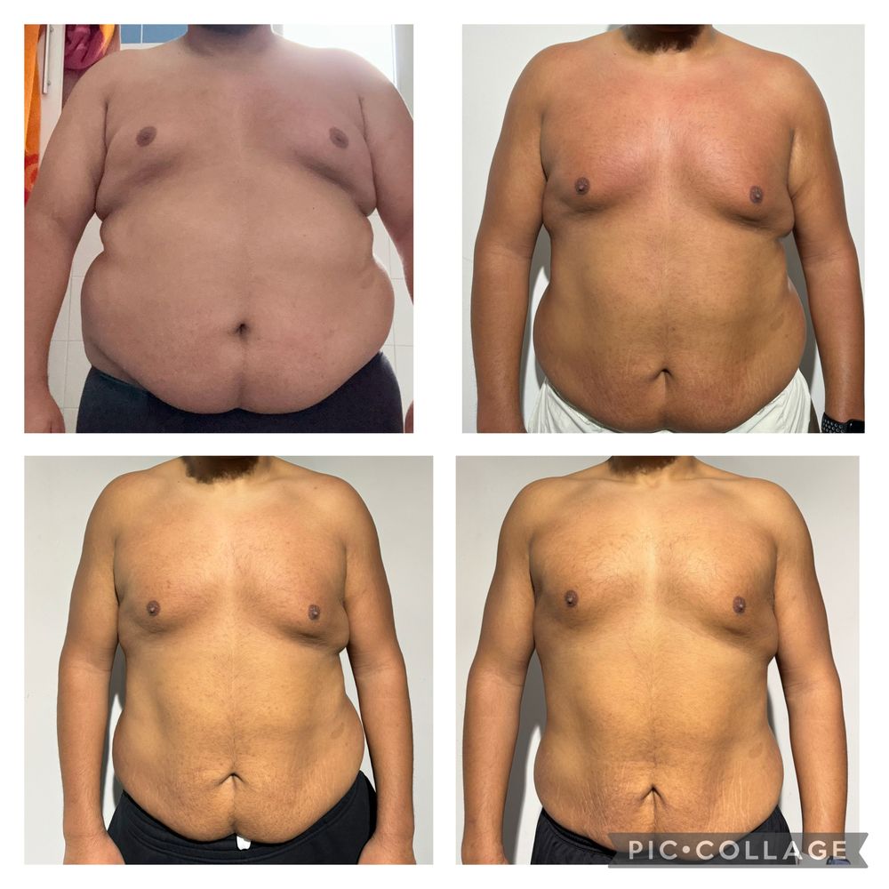 Montage avant / après d'un élève coaché par MES NUTRITION, photos de face, quatre étapes