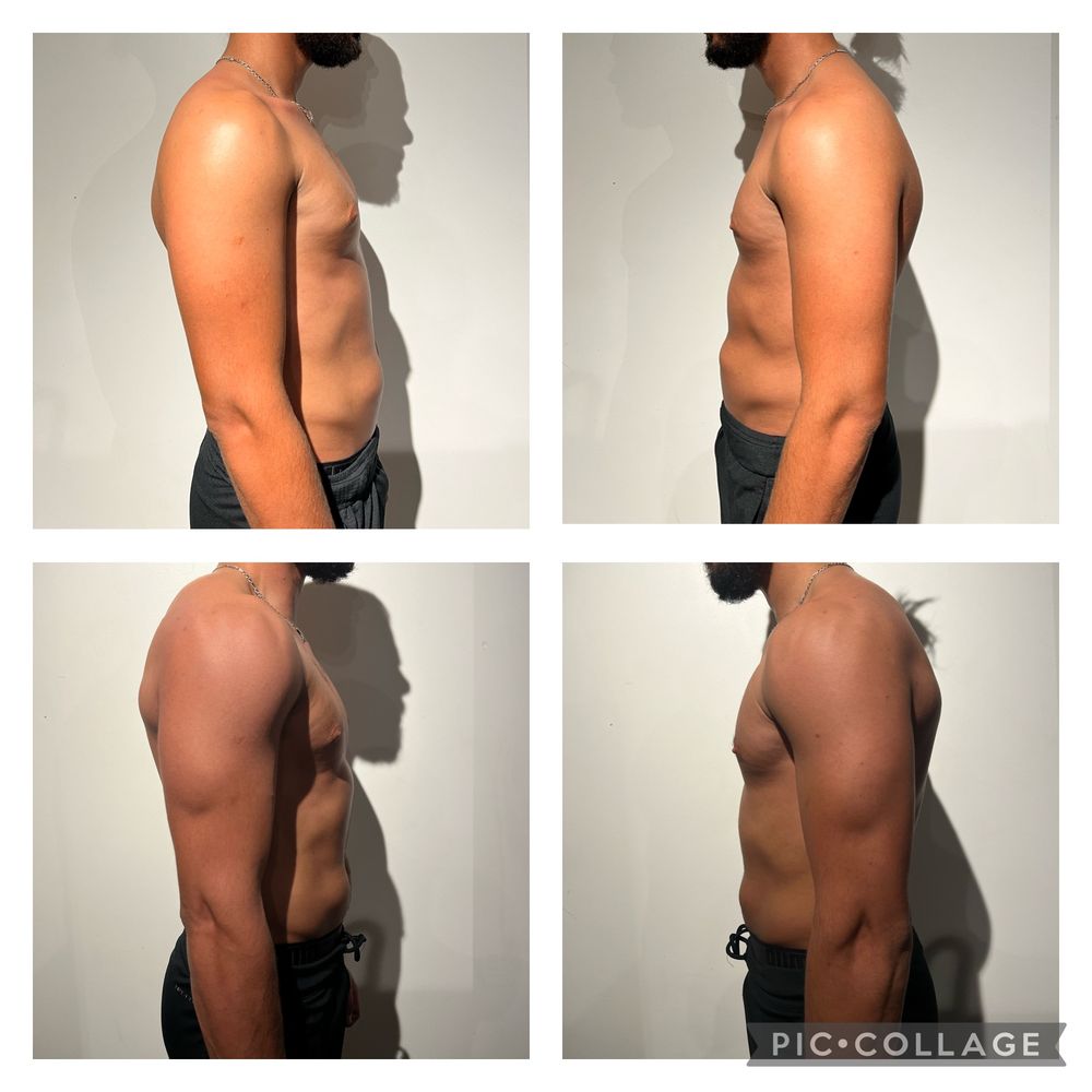 Montage avant / après d'un élève coaché par MES NUTRITION, photos de profil