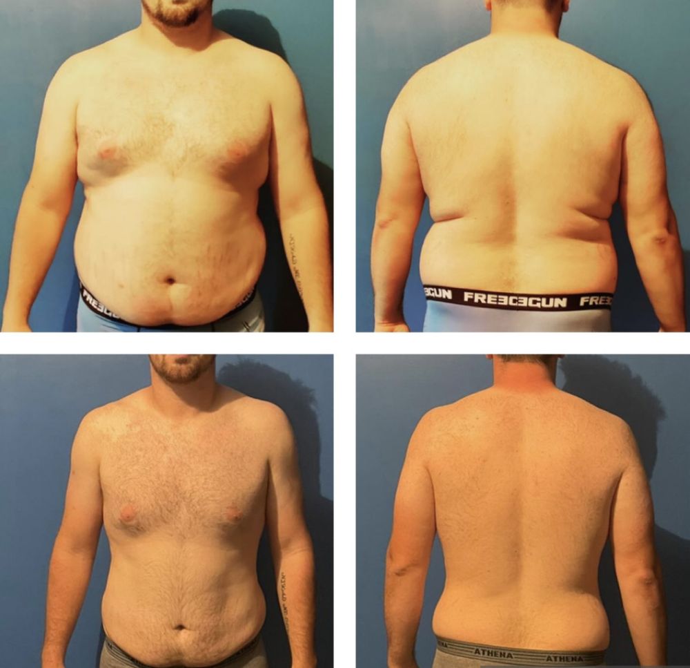 Montage avant / après d'un élève coaché par MES NUTRITION, photos de face et de dos